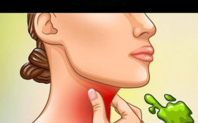 Le vere cause del catarro e del muco persistenti in gola e come eliminarli!