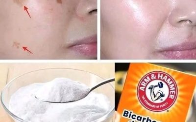 4 modi per eliminare le macchie dell’età con il bicarbonato di sodio per una pelle più giovane e uniforme