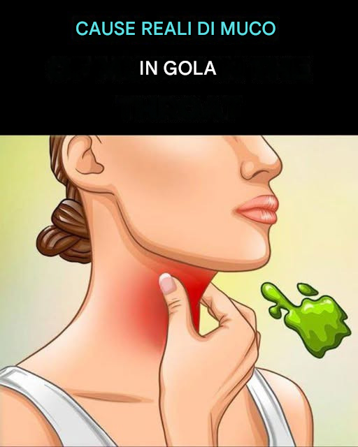 Le vere cause del catarro e del muco persistenti in gola e come eliminarli!