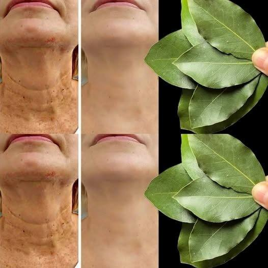 L’alloro è 100.000 volte più potente del Botox? | Un rimedio naturale contro le rughe, anche a 70 anni!