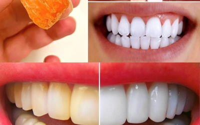 10 trucchi naturali per sbiancare i denti a casa in soli 3 giorni (senza bisogno del dentista)