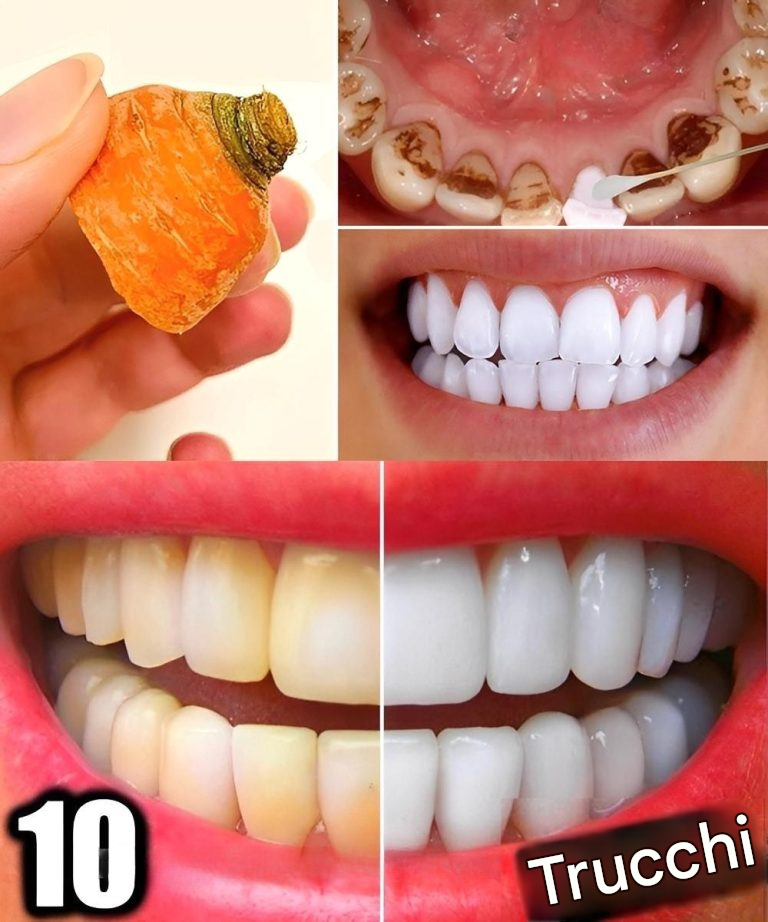 10 trucchi naturali per sbiancare i denti a casa in soli 3 giorni (senza bisogno del dentista)