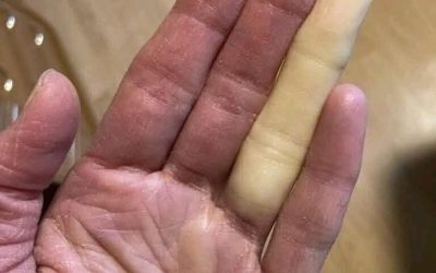 Queste sono le conseguenze di dormire con… Vedi altro