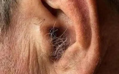 LO SAPEVI? Se ti crescono i peli sulle orecchie, è perché il tuo corpo è…