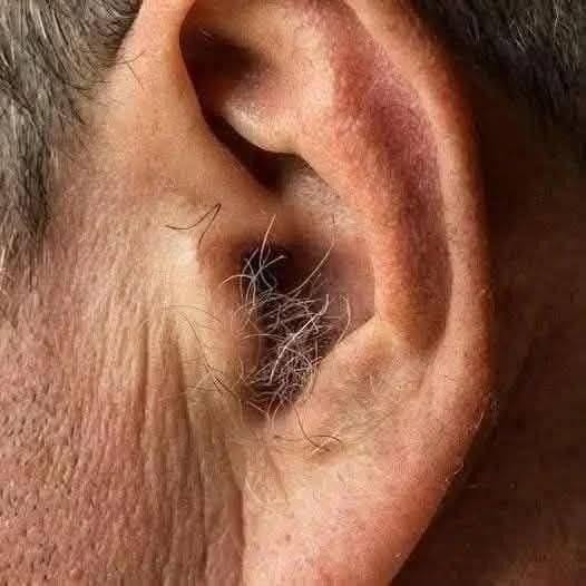 LO SAPEVI? Se ti crescono i peli sulle orecchie, è perché il tuo corpo è…