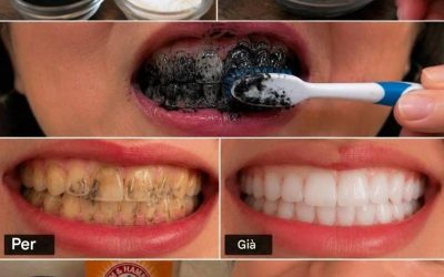 Dì addio ai denti gialli con questo duo sbiancante naturale.