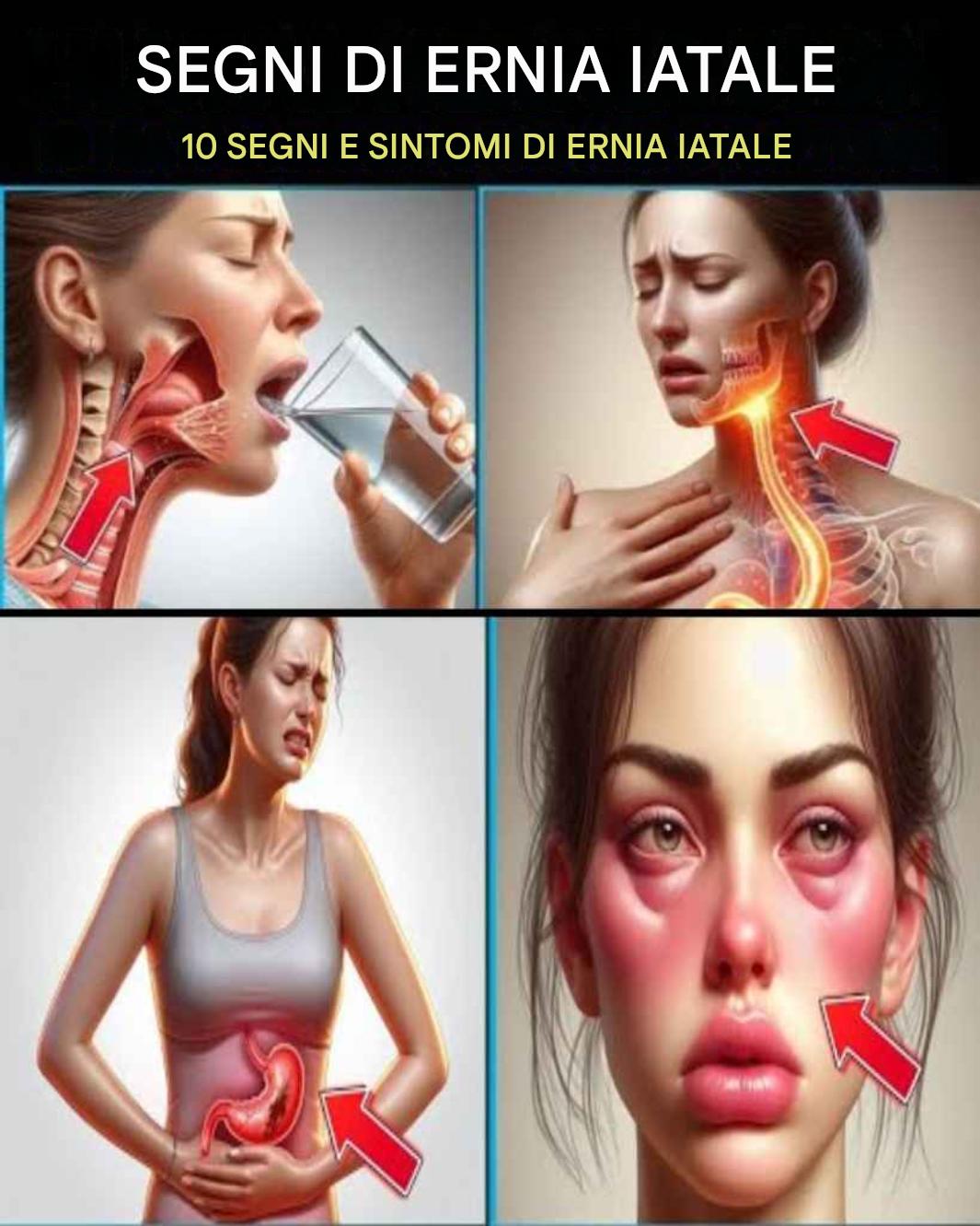 10 segni e sintomi di ernia iatale che dovresti conoscere!
