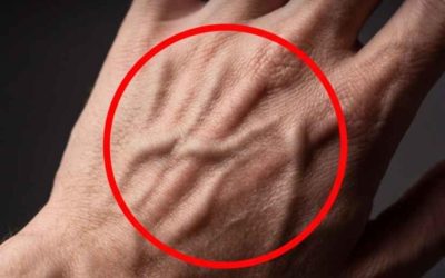 Perché le vene sono così evidenti? Decifriamo un fenomeno comune.