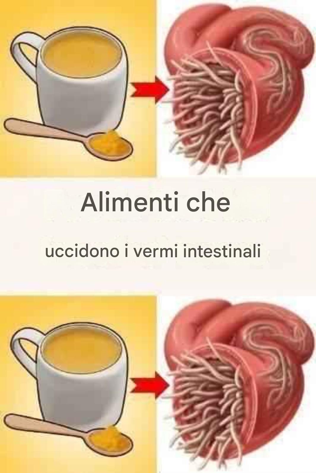 7 alimenti che uccidono i vermi intestinali