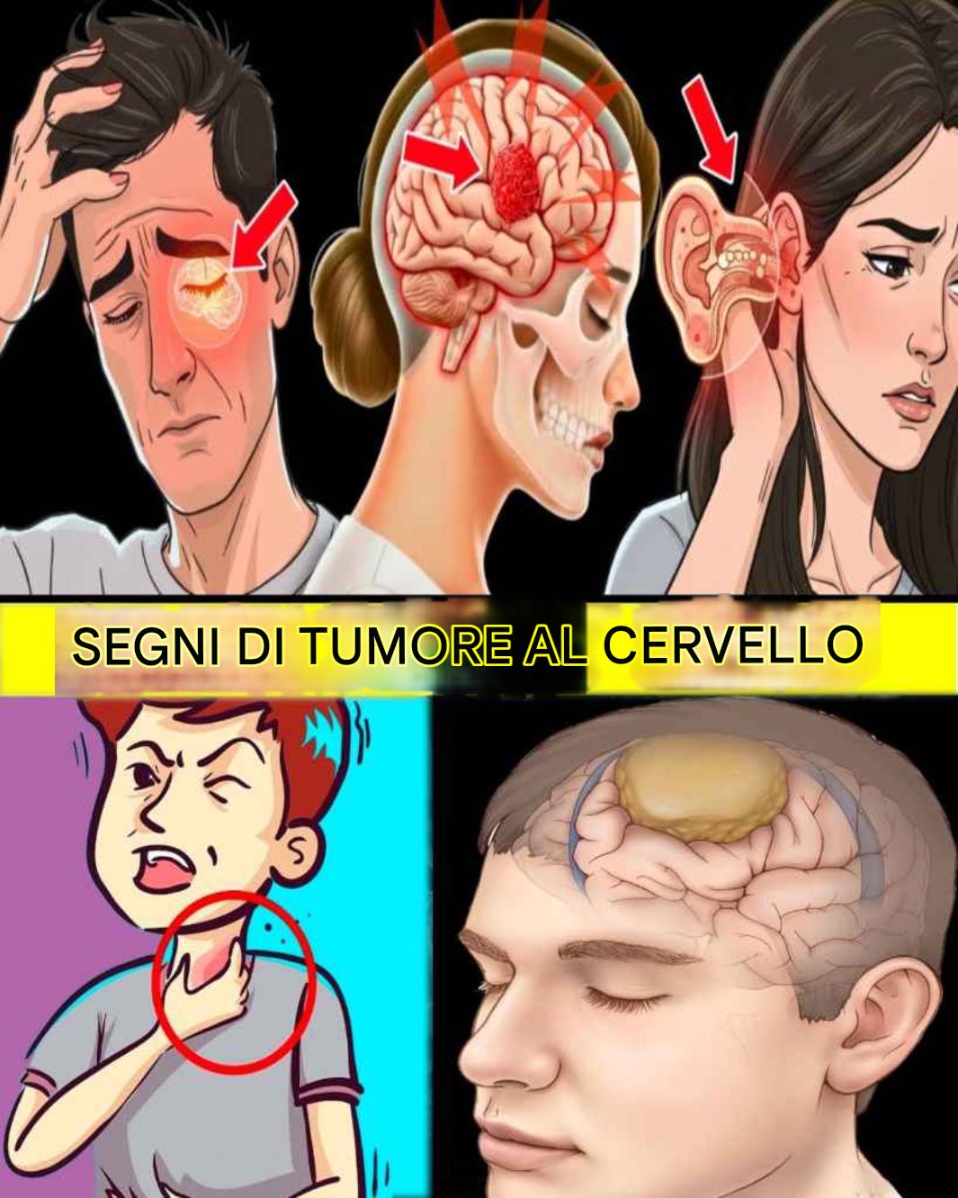 Non perderti questi 10 segnali precoci che potrebbero indicare la presenza di un tumore al cervello: potrebbero salvarti la vita.