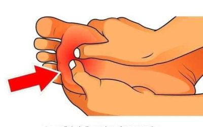 8 segni che vous consommez trop de sucre!